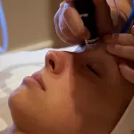 Hydrafacial Syndeo