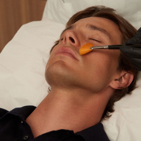 Tratamientos Personalizados Acné