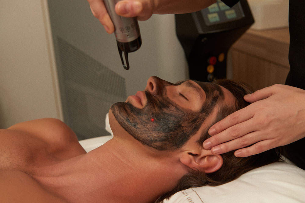 Carbon Peel By Alma Q en The Beauty Concept