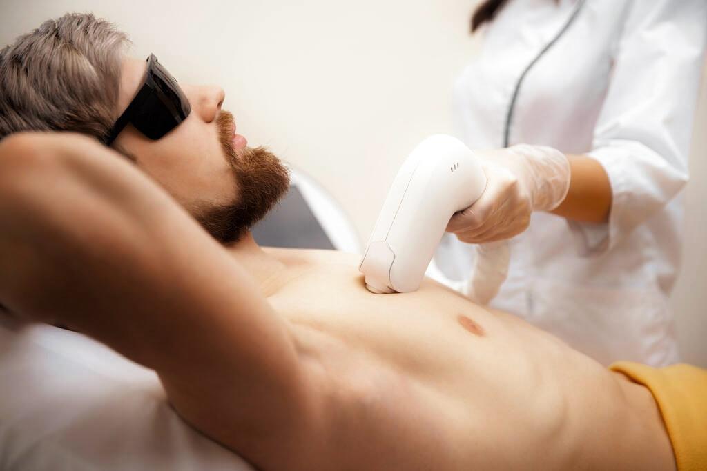 depilacion laser diodo hombre